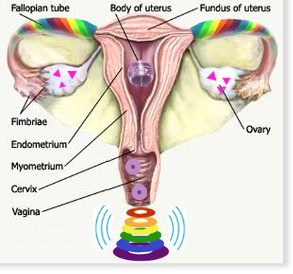 Is the disco ball an IUD too? That would be awesome!