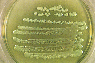 Pseudomonas aeruginosa, yick!