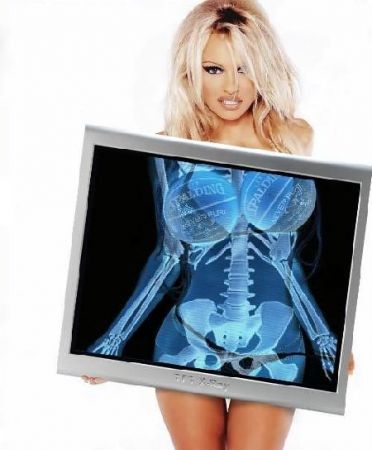 Pamela Anderson X Ray
